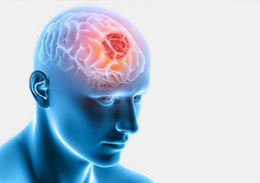 Brain Tumor Treatment